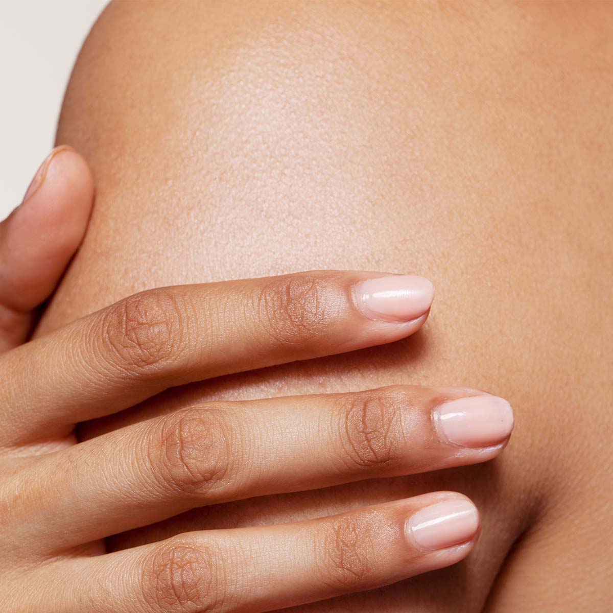 Bumps on your arms or thighs? It’s called Keratosis Pilaris. And 60% of Indian women have it.