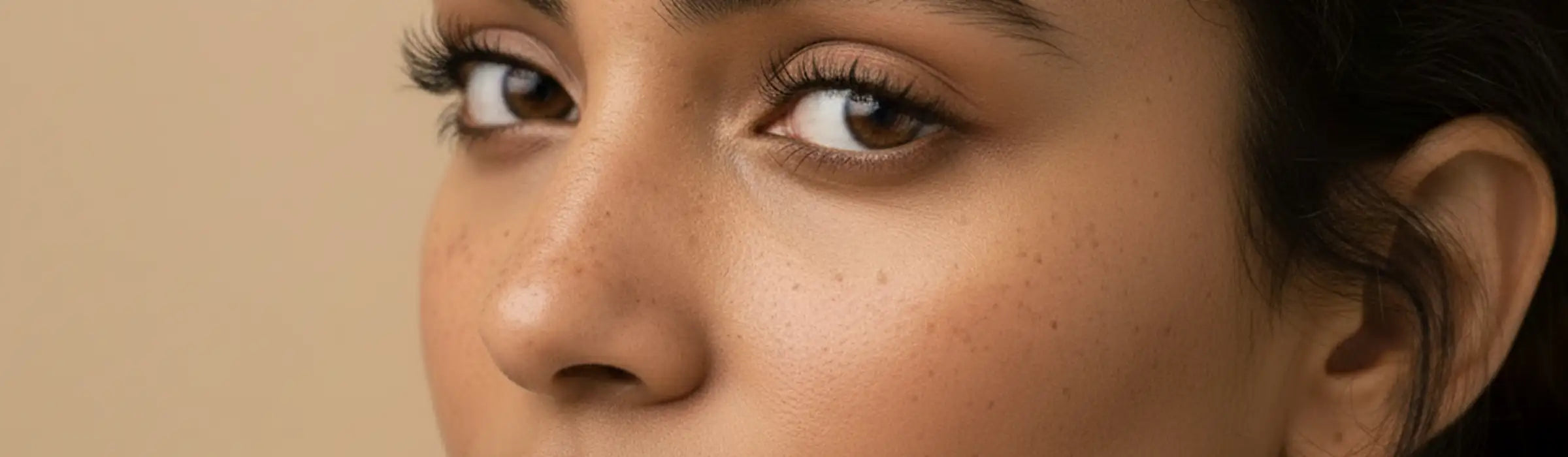 Hyperpigmentation