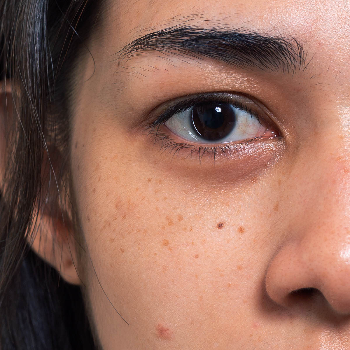 Boofootel Sooperboost Face Serum targets pigmentation and dark spots