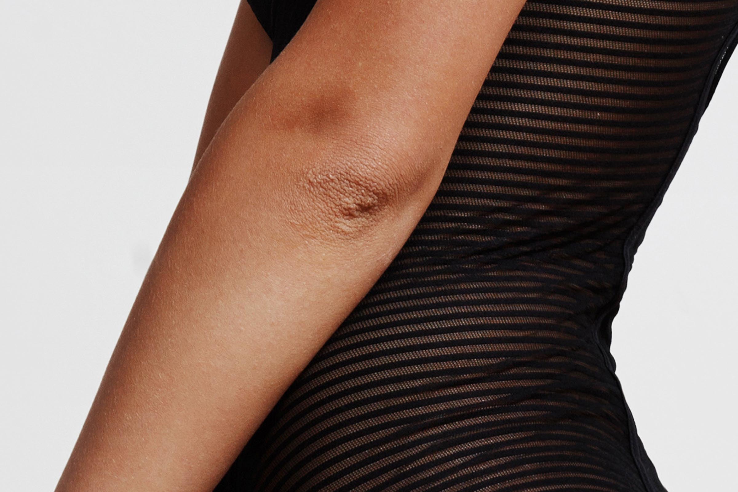 Boofootel Soopersmooth Body serum smoothens rough, bumpy, dark elbows