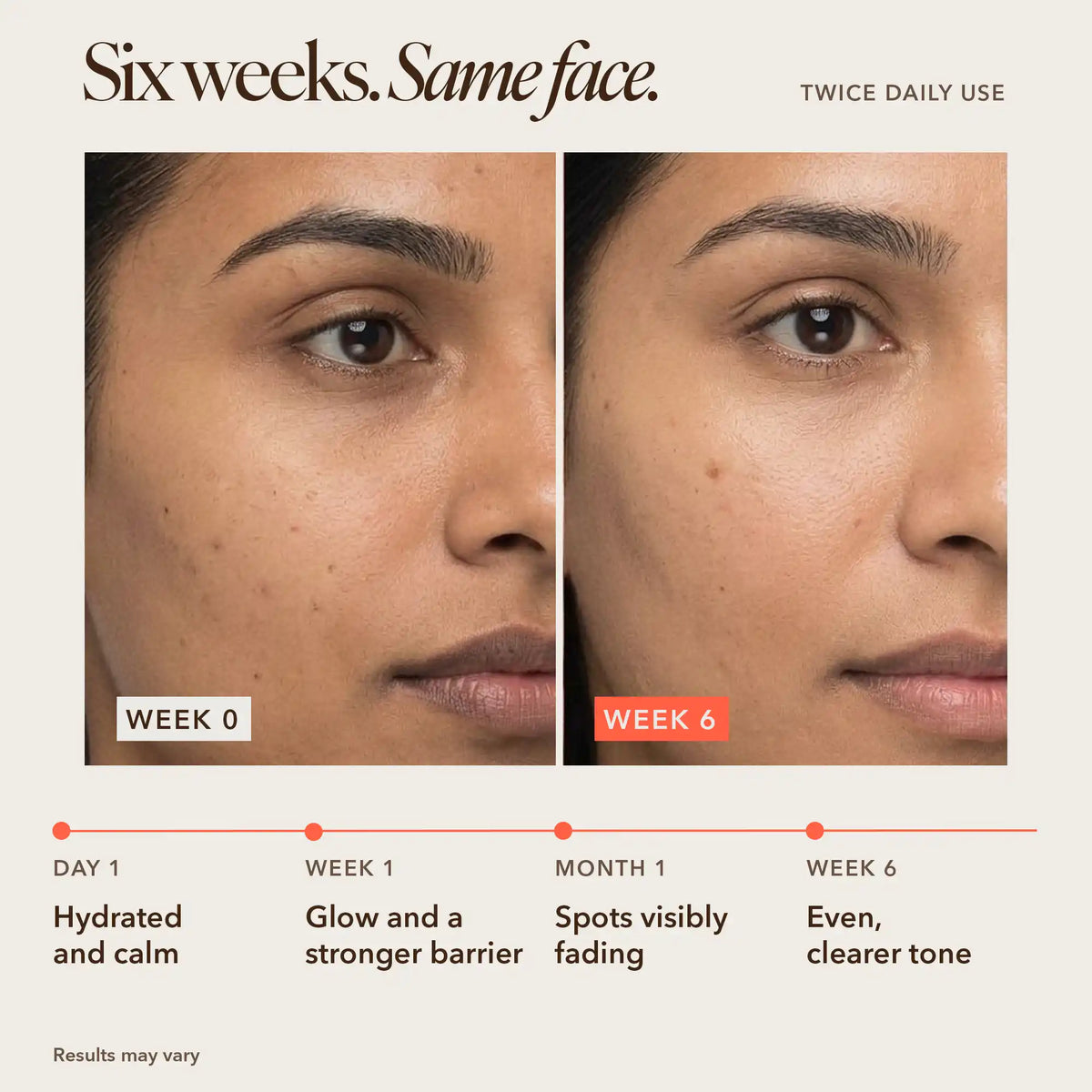 Before and after Sooperboost on Indian skin, week 0 vs week 6, showing faded dark spots and a more even skin tone