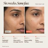Before and after Sooperboost on Indian skin, week 0 vs week 6, showing faded dark spots and a more even skin tone