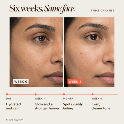 Before and after Sooperboost on Indian skin, week 0 vs week 6, showing faded dark spots and a more even skin tone