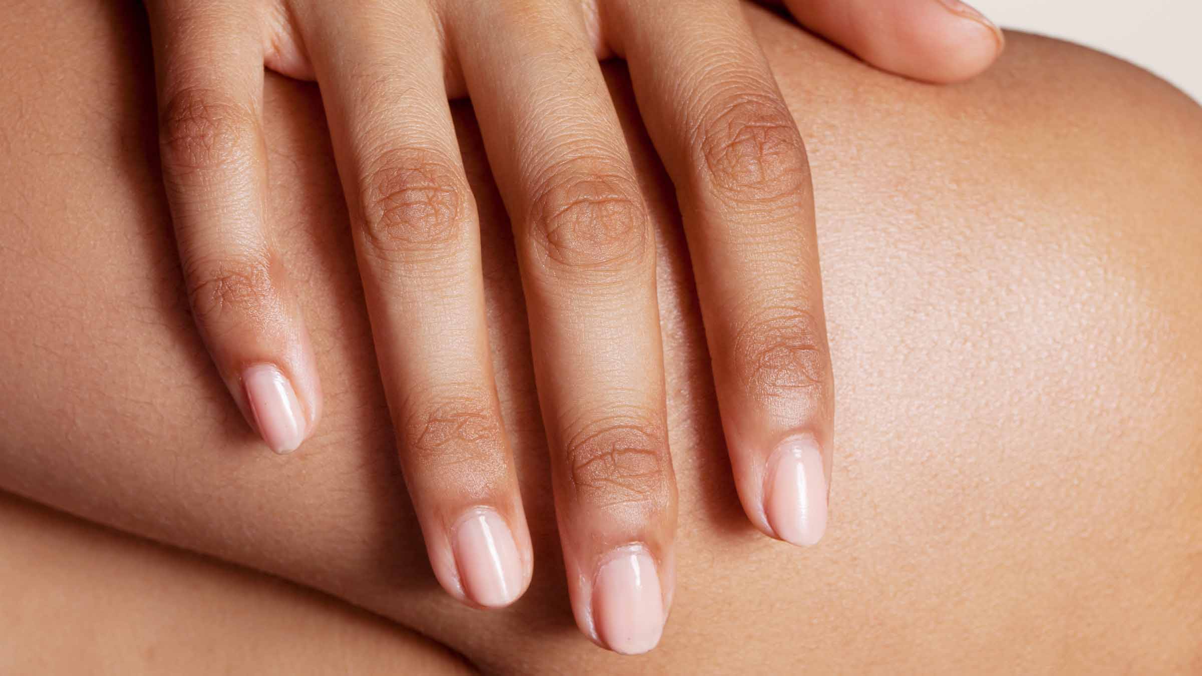 Keratosis pilaris bumps commonly called strawberry skin on Indian skin