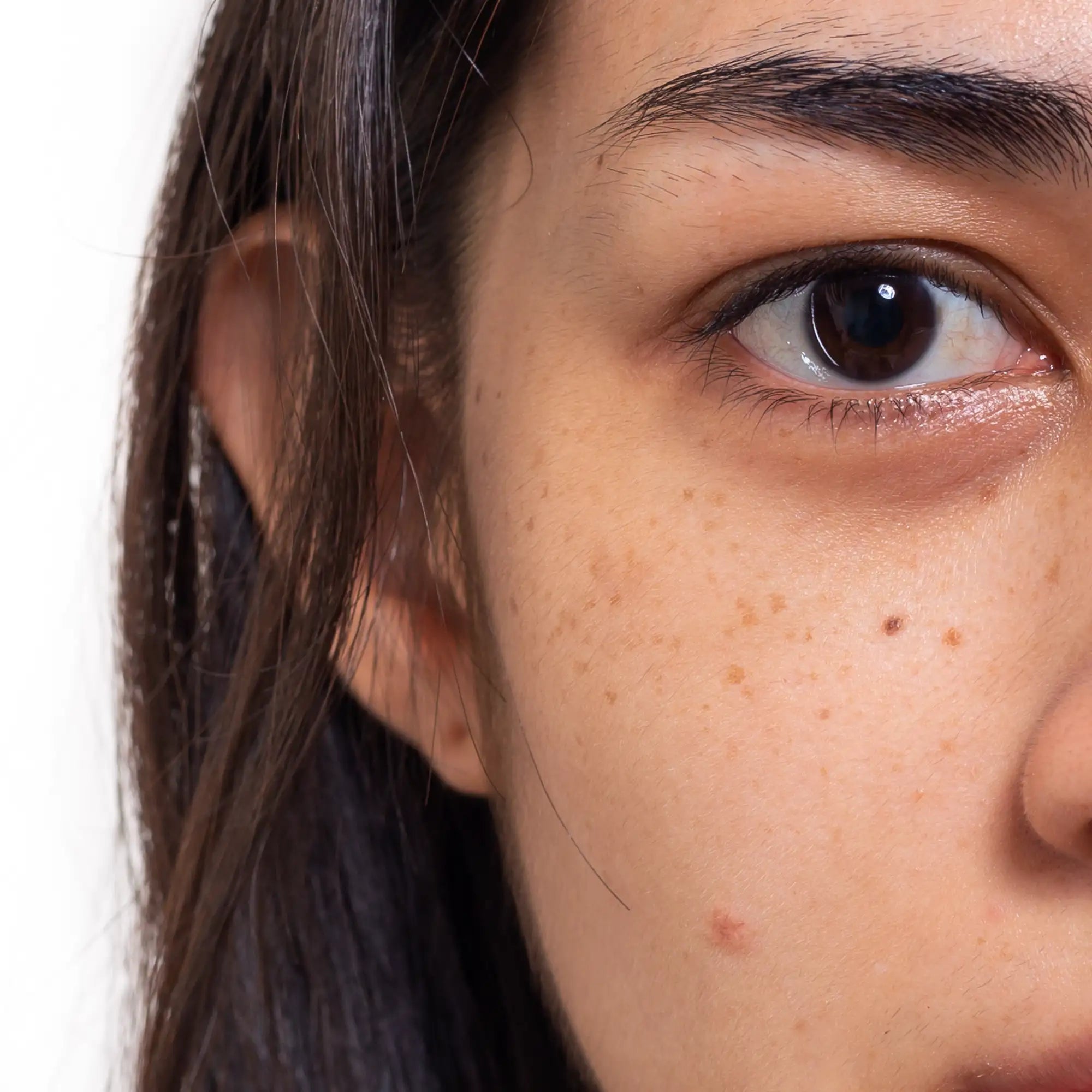 Common Indian skin concerns including pigmentation, uneven skin tone, dullness, texture, and post-acne marks.